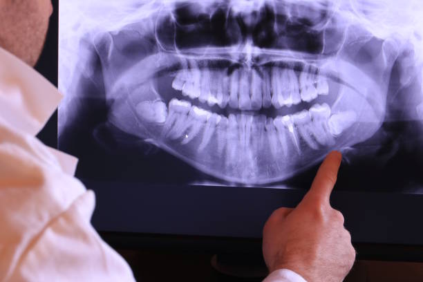Best Emergency Dental Care for Broken or Chipped Teeth in Stanton, MI