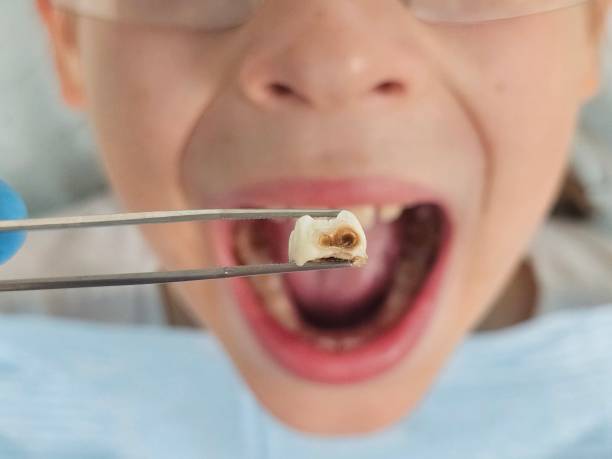Best Emergency Denture Repair in Stanton, MI