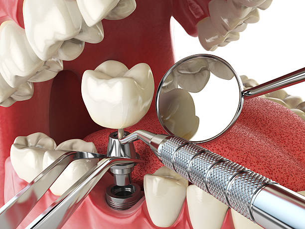 Best Weekend Emergency Dentist in Stanton, MI